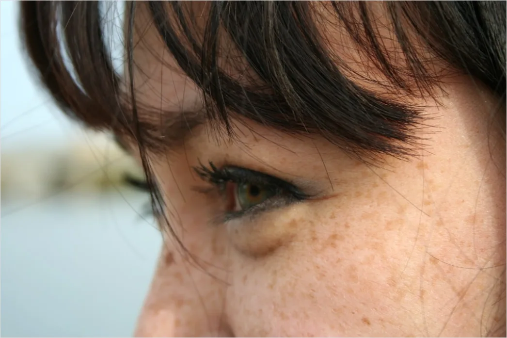 Freckles Close Up 4bf3