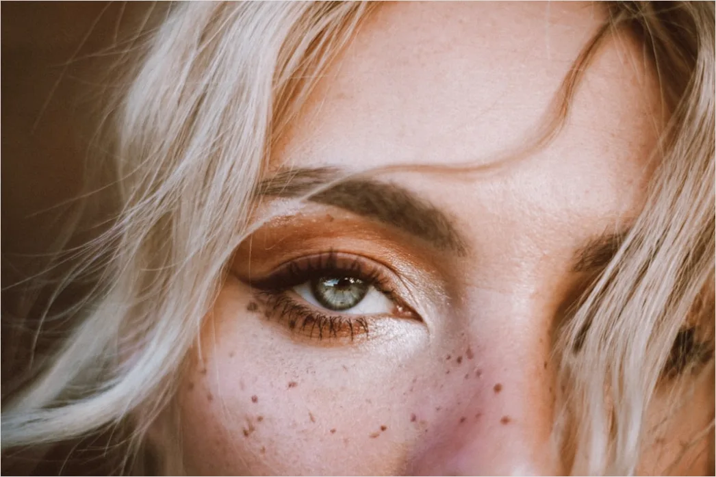 Detail Freckles Close Up Number 13