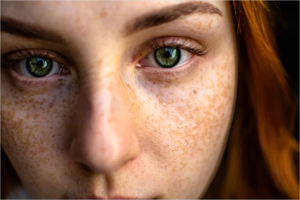 Detail Freckles Close Up Number 14