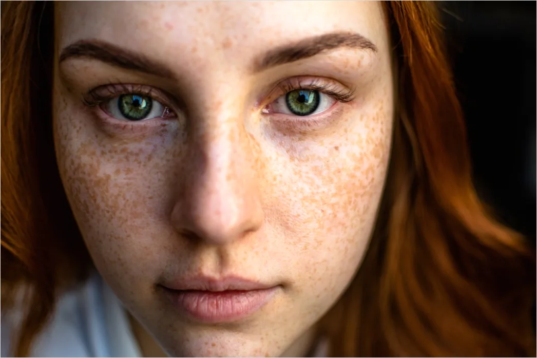 Detail Freckles Close Up Number 15