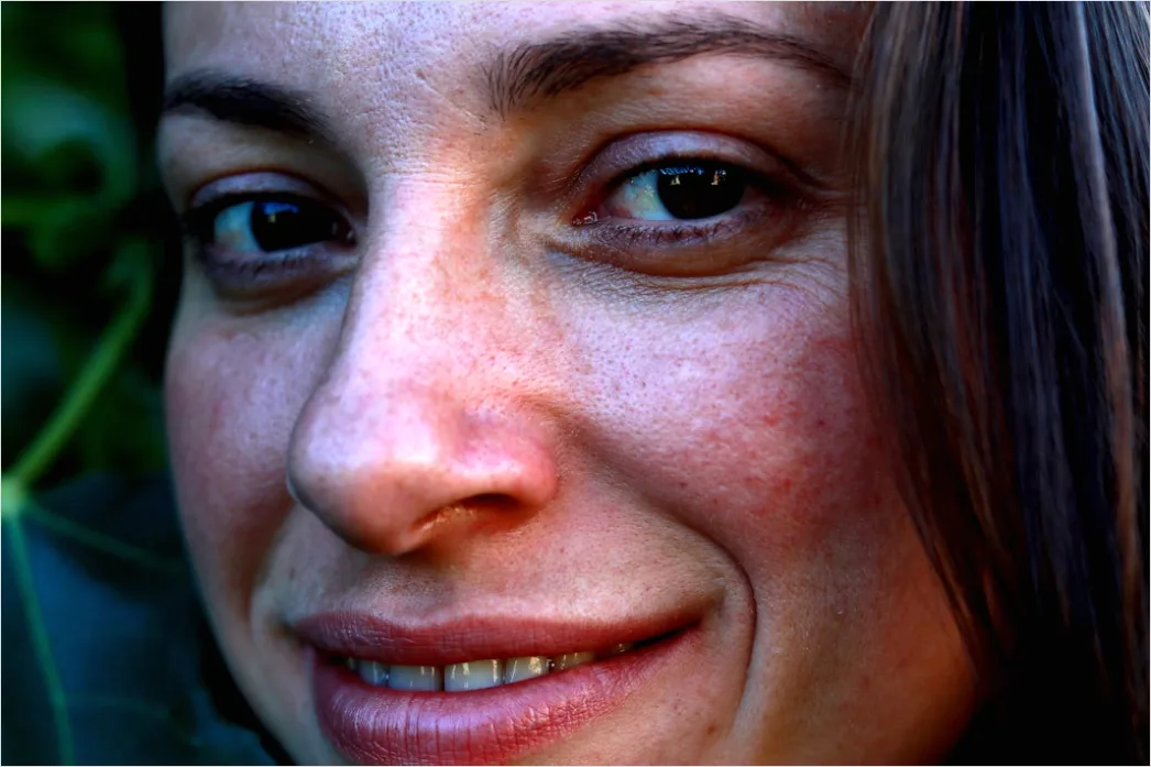 Detail Freckles Close Up Number 17