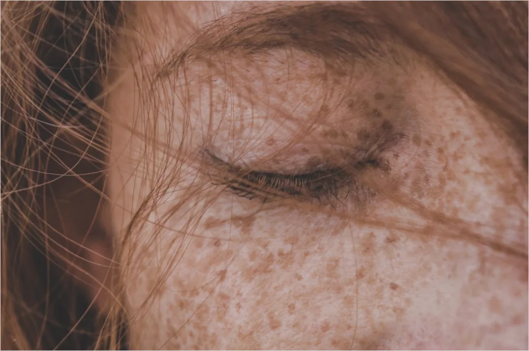 Detail Freckles Close Up Number 18