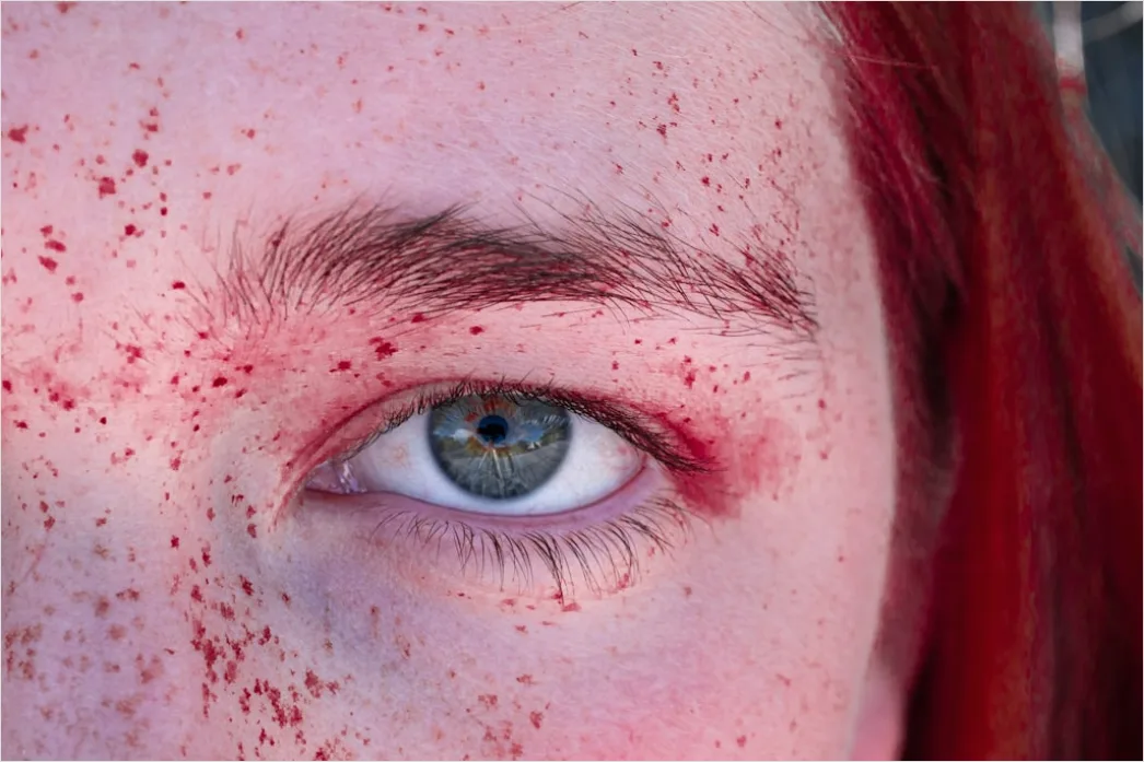 Detail Freckles Close Up Number 20