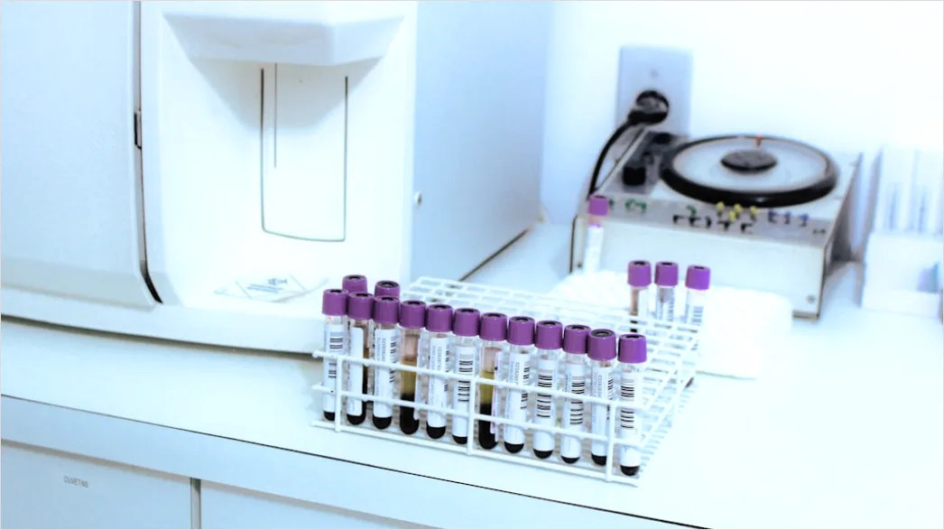 Detail Antibody Testing Laboratory Equipment And Samples Number 11