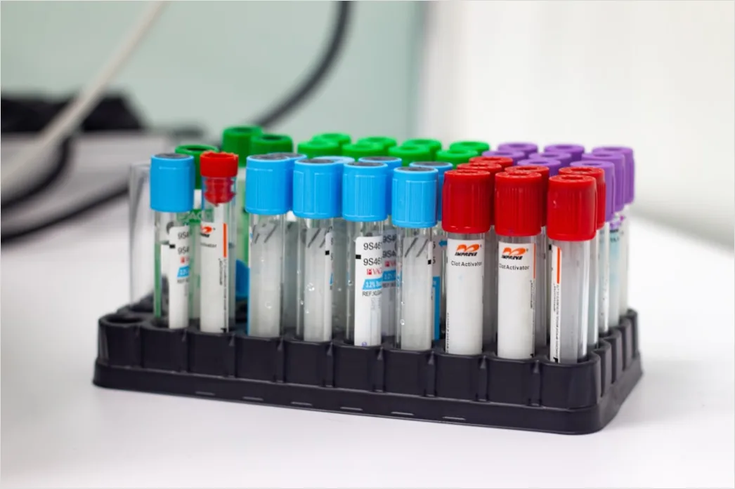 Detail Antibody Testing Laboratory Equipment And Samples Number 15
