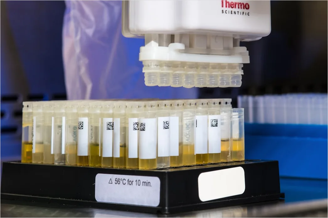 Detail Antibody Testing Laboratory Equipment And Samples Number 17