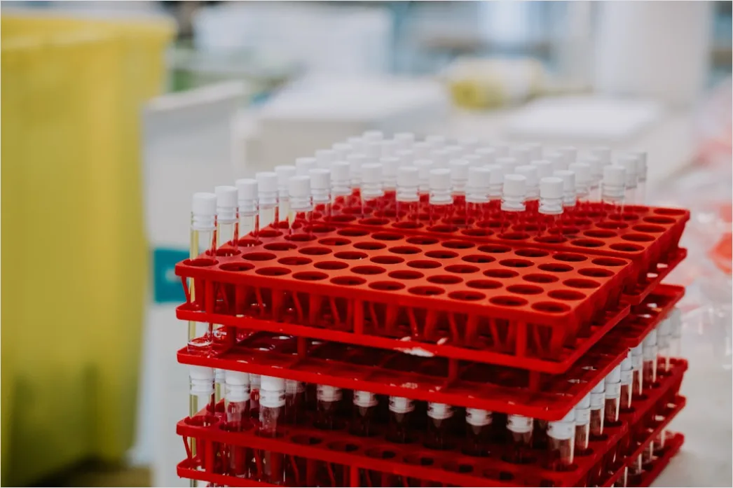 Detail Antibody Testing Laboratory Equipment And Samples Number 18