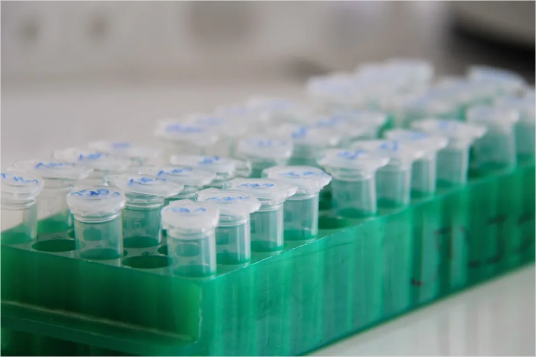 Detail Antibody Testing Laboratory Equipment And Samples Number 19