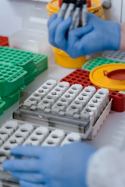Detail Biological Sample Storage Freezer Laboratory Interior Number 2