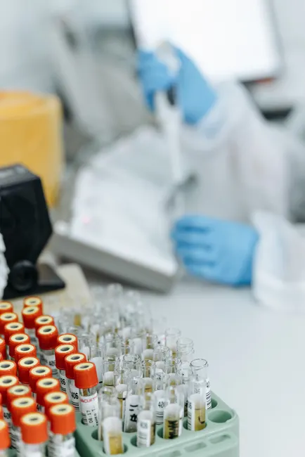Detail Biological Sample Storage Freezer Laboratory Interior Number 17