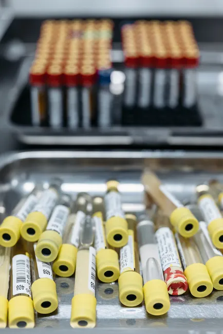 Detail Biological Sample Storage Freezer Laboratory Interior Number 19