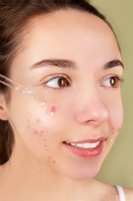 Detail Niacinamide Serum For Pores And Oil Control Number 11