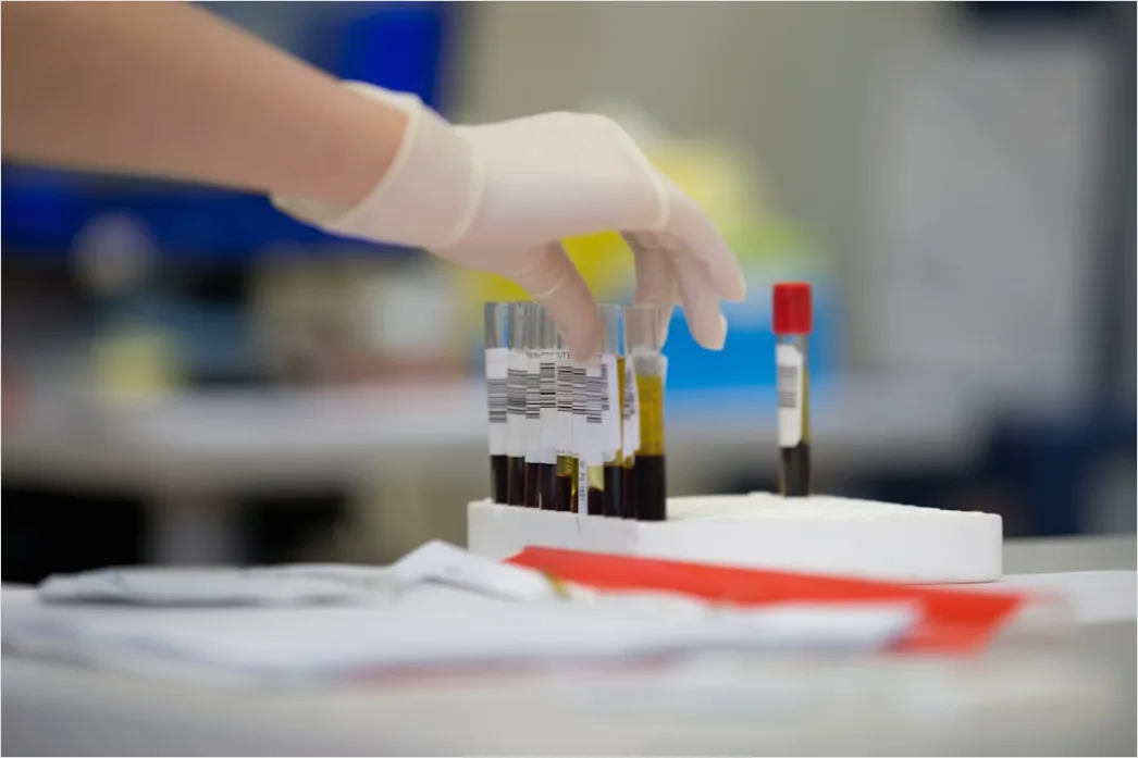 Detail Pathology Lab Technician Examining Tissue Samples Number 17