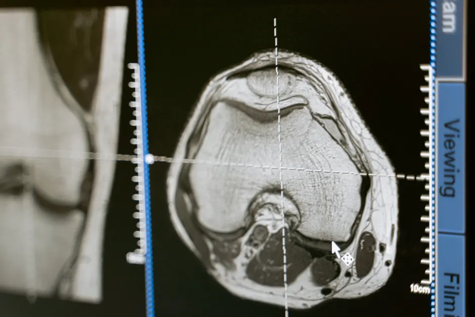 Detail Ct Kontrollraum Monitore Radiologie Arbeitsplatz Number 16