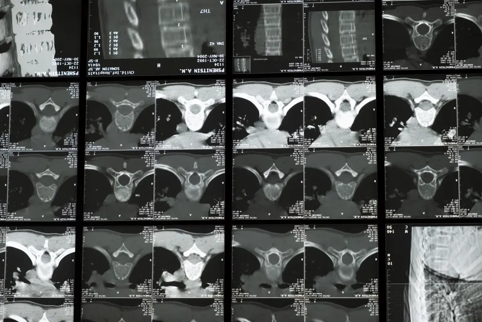 Detail Ct Kontrollraum Monitore Radiologie Arbeitsplatz Number 20