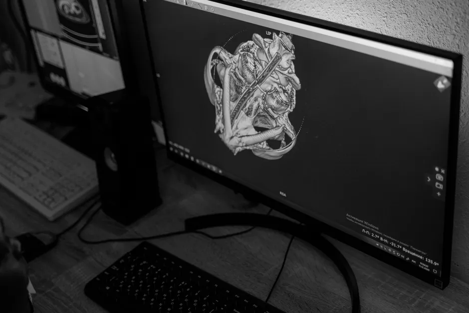 Detail Ct Kontrollraum Monitore Radiologie Arbeitsplatz Number 3