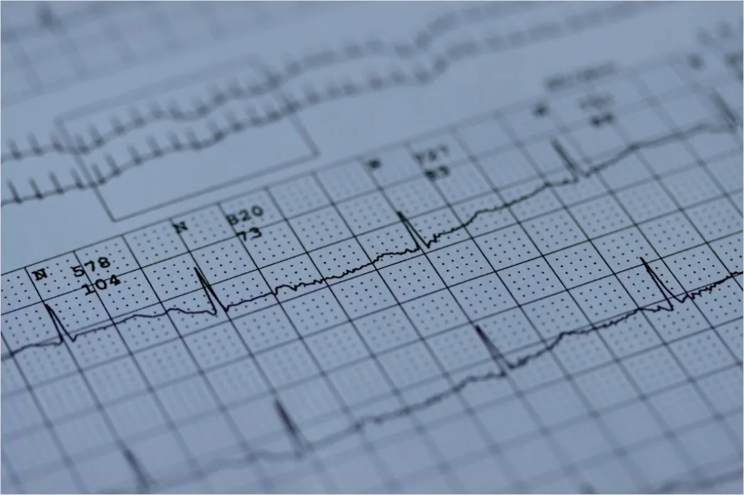 Ekg Monitor Herzlinie Nahaufnahme