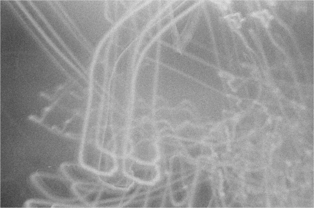 Detail Röntgenbild Auf Bildschirm Nahaufnahme Number 15