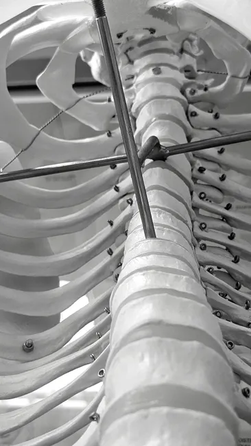 Detail Rückenschule Kurs In Physiopraxis Number 7