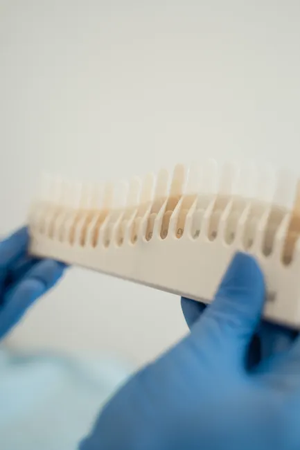Zahnarzt Haelt Farbring Zahnfarbe Bestimmung 5977
