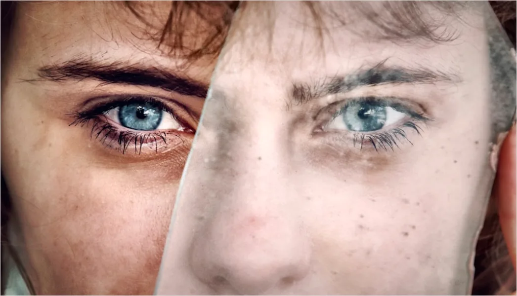 Before After Akne Teintsmoothing Foto Collage 7202