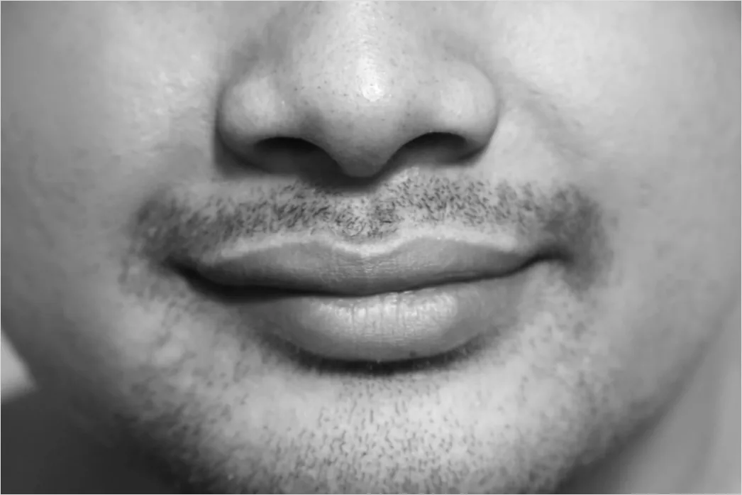 Lippenpflege Winter Cracked Lips Nahaufnahme Foto 32a2