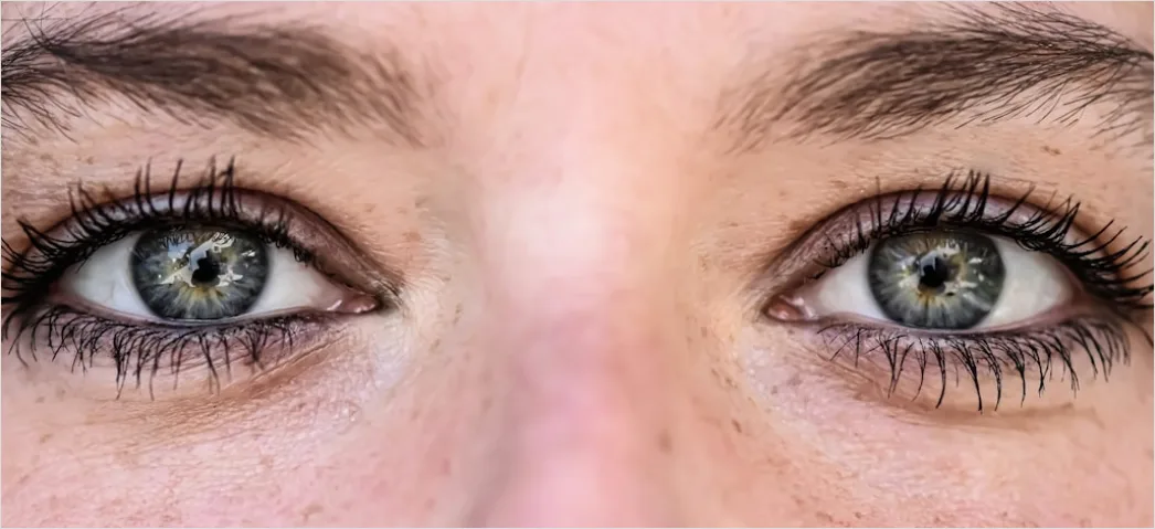 Detail Wimpern Lifting Vorher Nachher Foto Collage Number 3