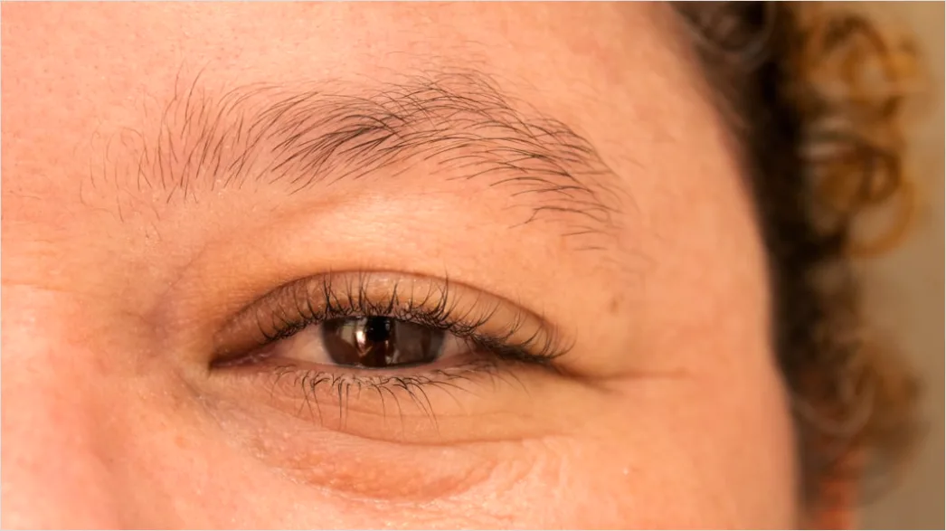 Detail Wimpern Lifting Vorher Nachher Foto Collage Number 4