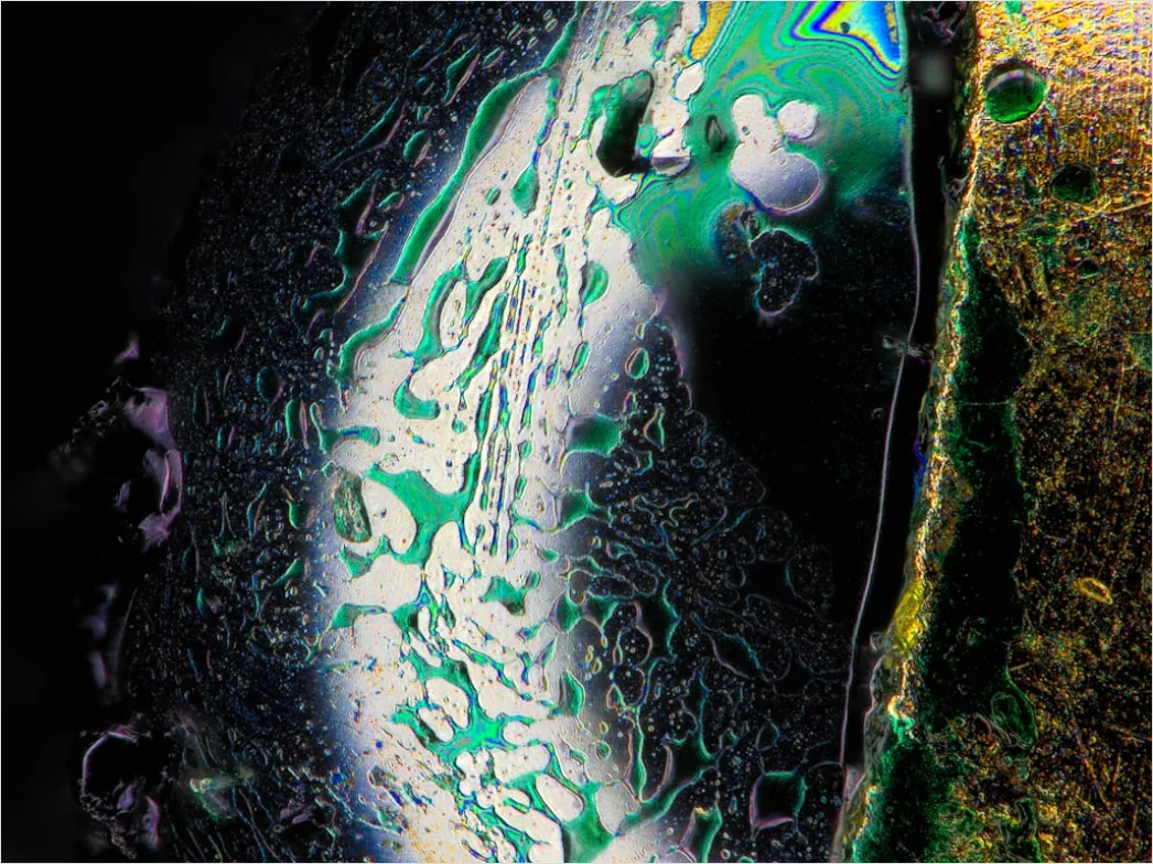 Chromosomen Unter Dem Mikroskop Bild 2a87