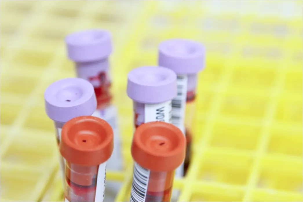 Molekularbiologie Labor Mit Dna Test Foto