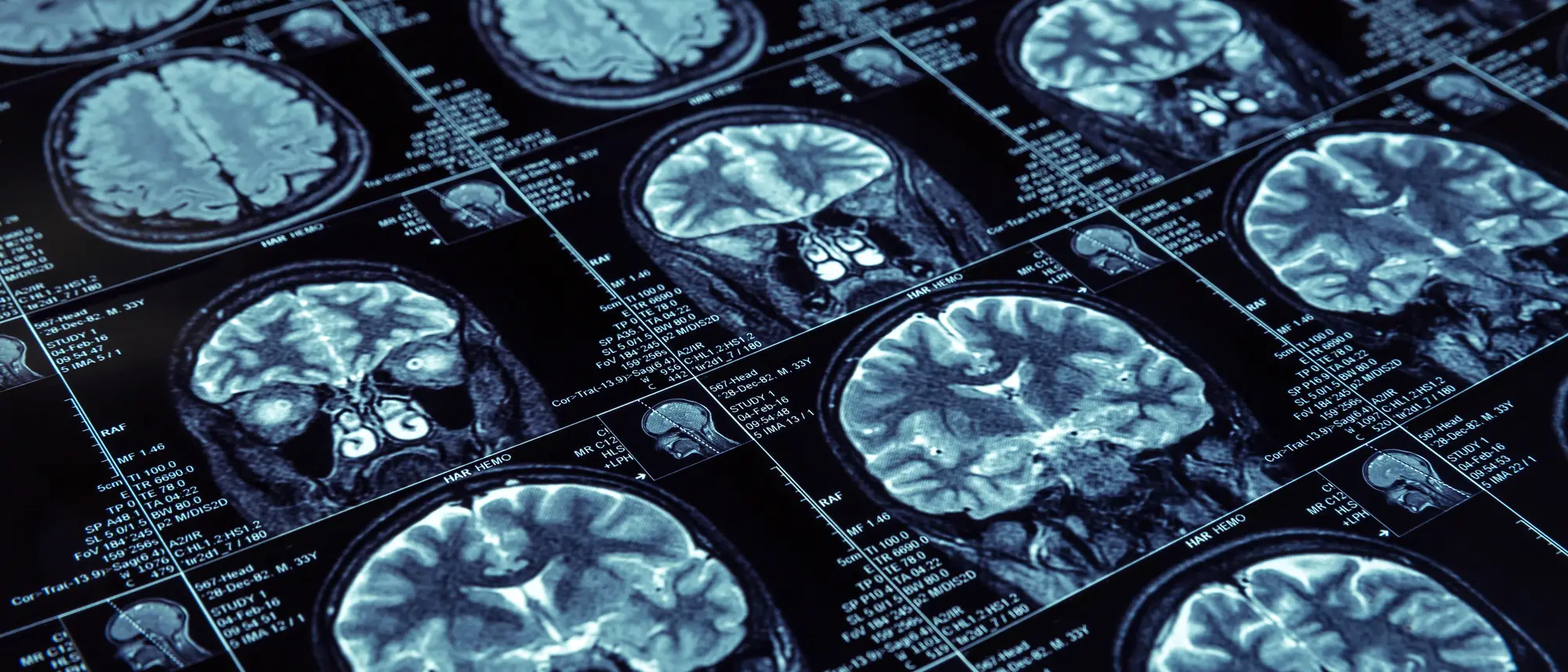 Neurowissenschaftler Analysiert Gehirnscans Foto 6314