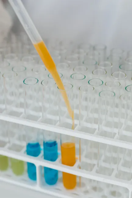 Pipette Tropft Fluessigkeit In Reagenzglas Foto