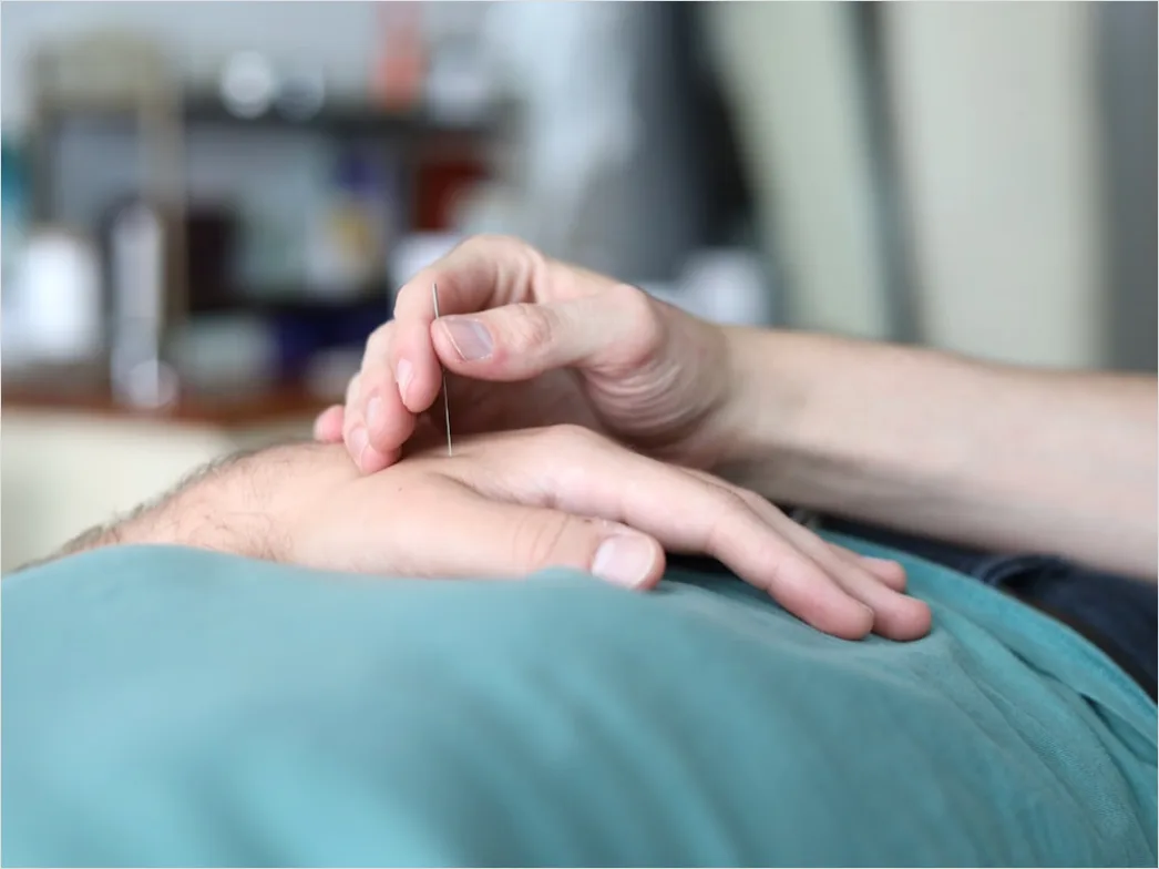 Detail Acupuncture Needles Close Up Treatment Number 2