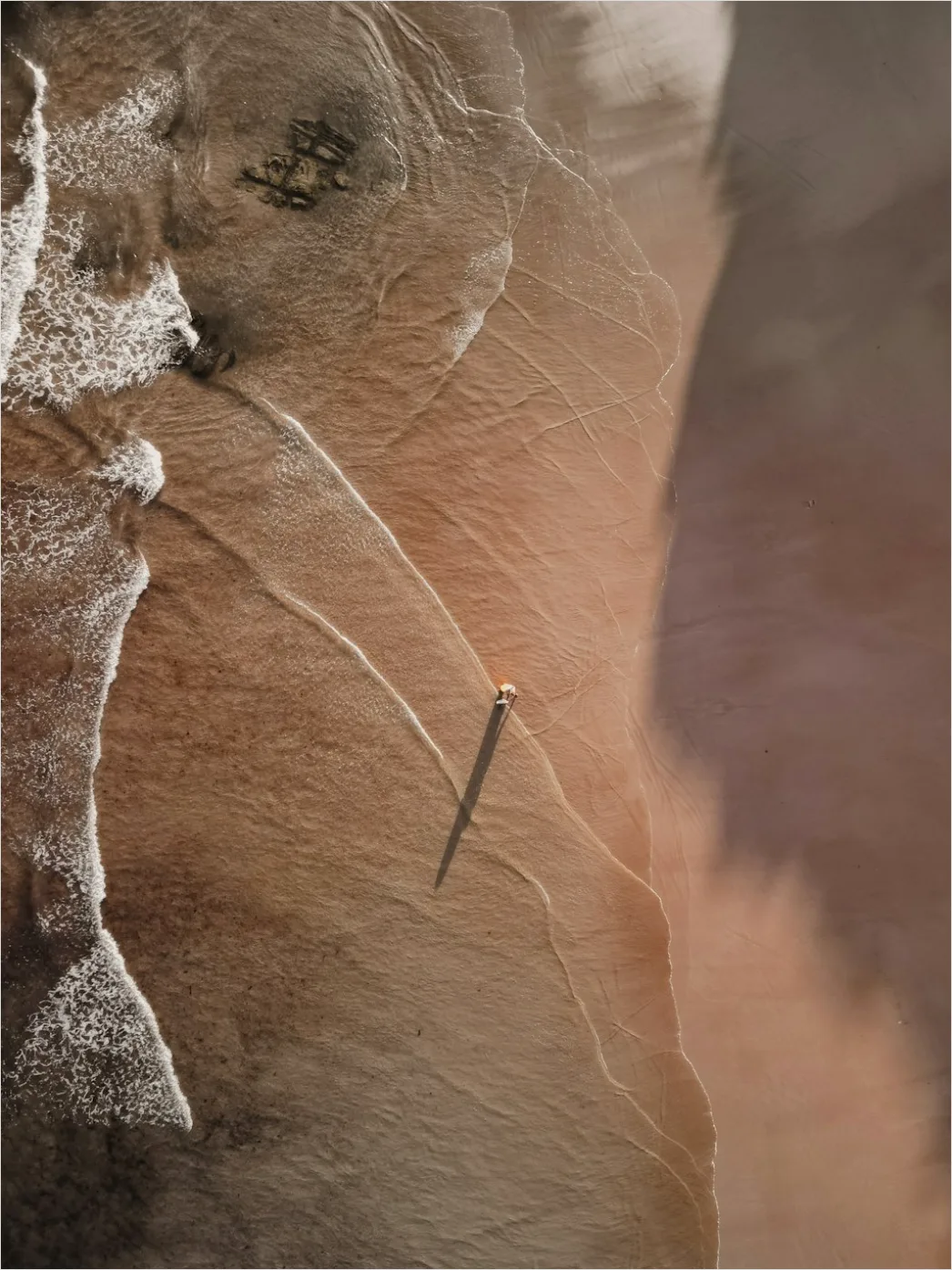 Detail Acupuncture Needles Close Up Treatment Number 15