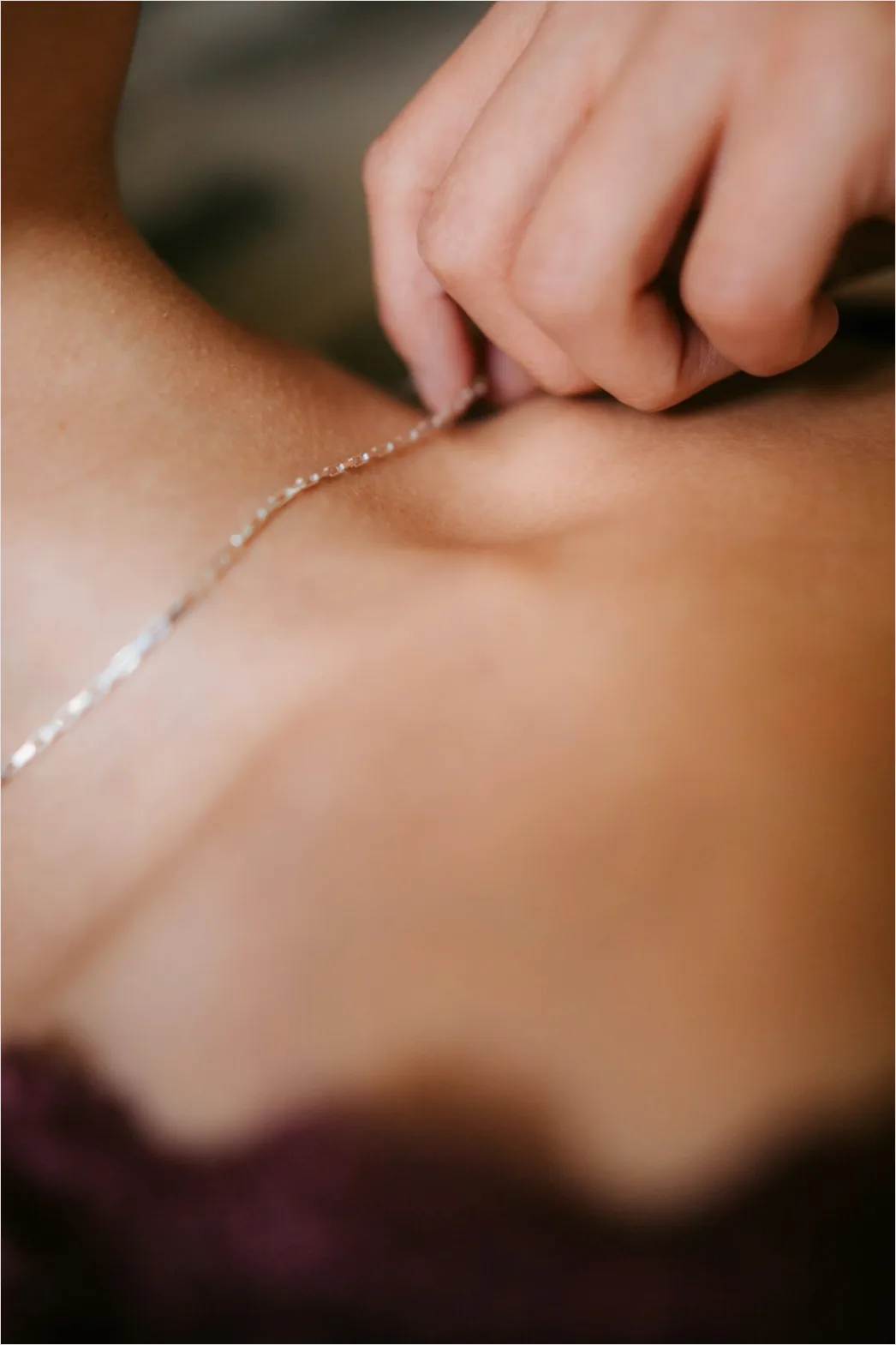 Detail Acupuncture Needles Close Up Treatment Number 4