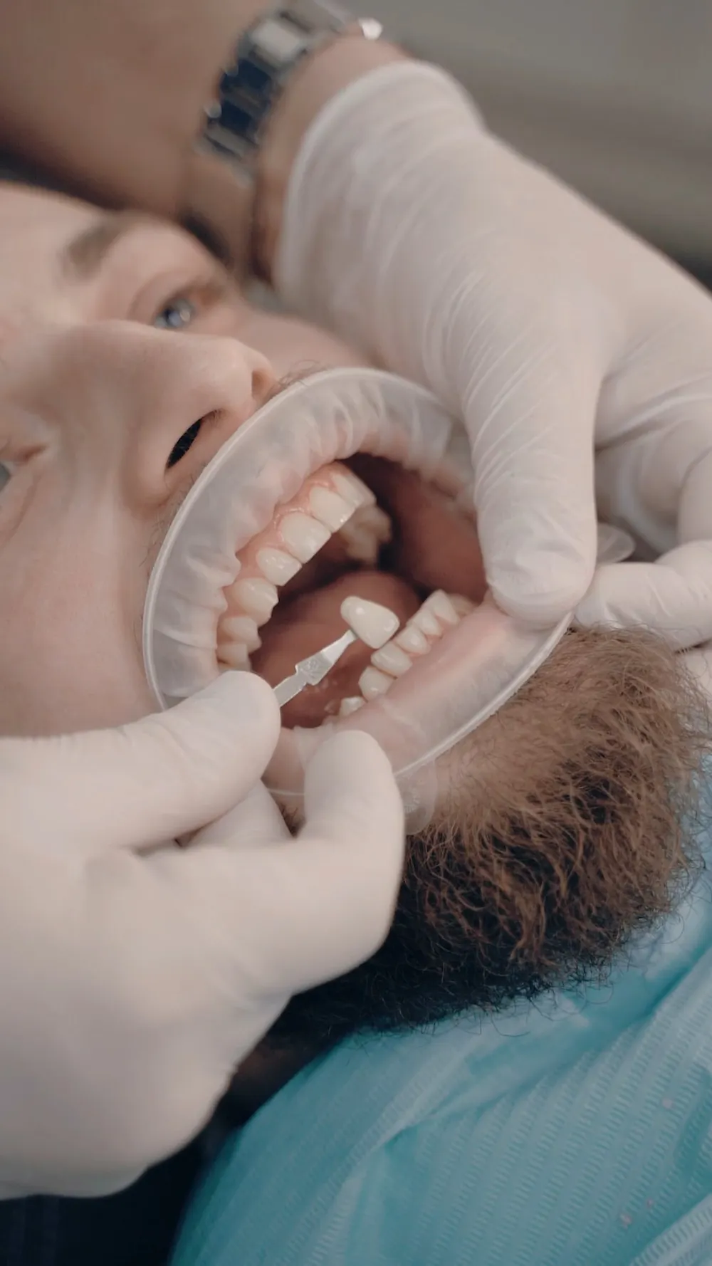 Detail Dentist Examining Patient Mouth Close Up Number 12