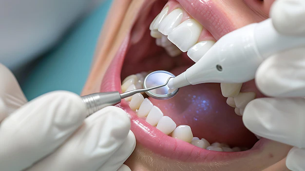 Detail Dentist Examining Patient Mouth Close Up Number 16