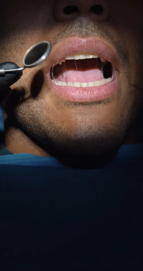 Detail Dentist Examining Patient Mouth Close Up Number 19