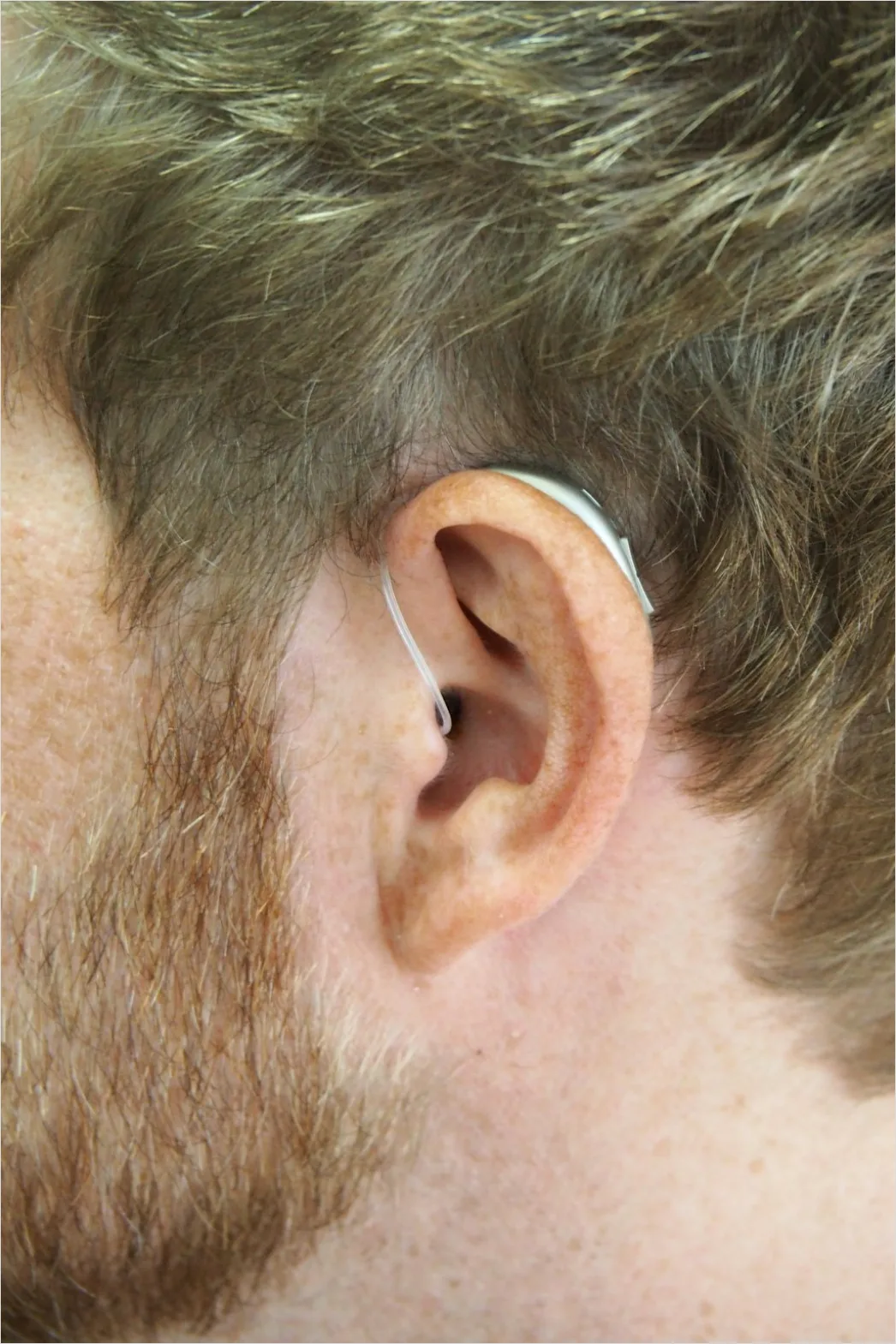 Detail Hearing Aids In Hand Close Up Number 12