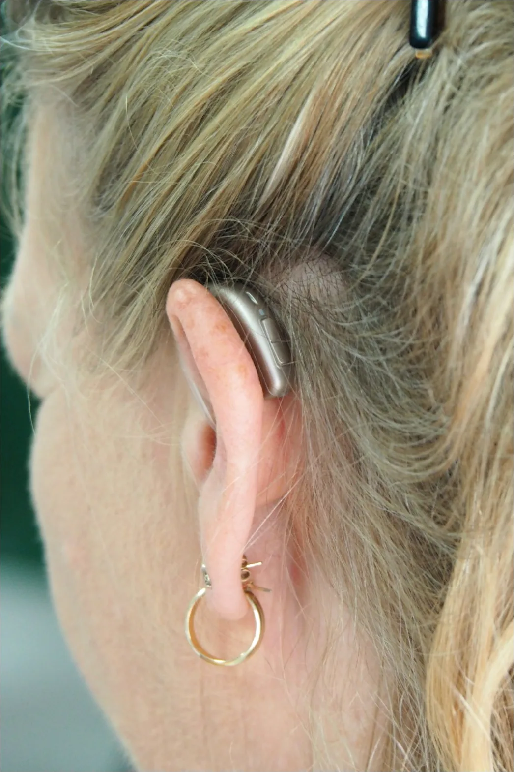 Detail Hearing Aids In Hand Close Up Number 4
