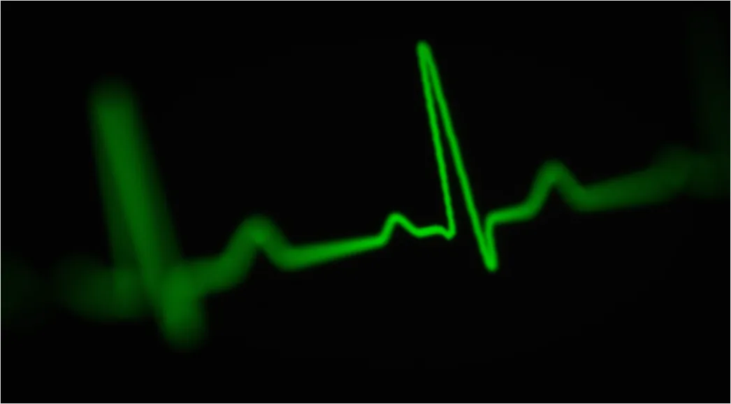 Icu Monitor Alarms Waveform 39bc