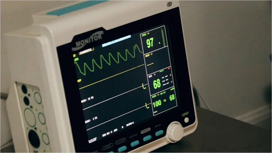 Detail Icu Monitor Alarms Waveform Number 2
