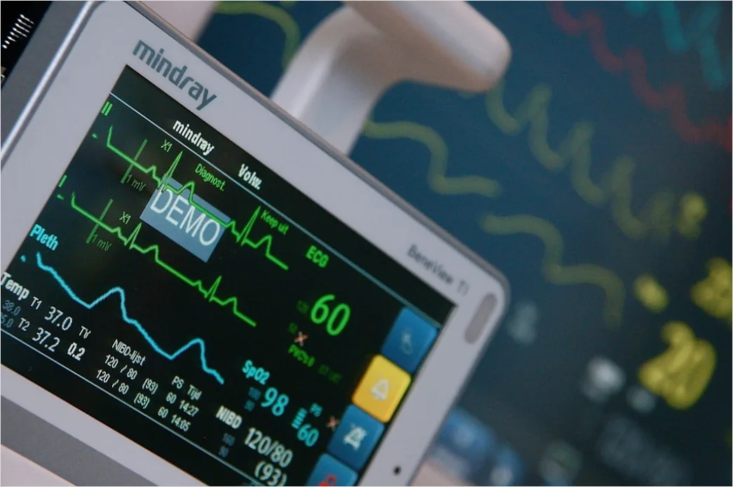 Detail Icu Monitor Alarms Waveform Number 11