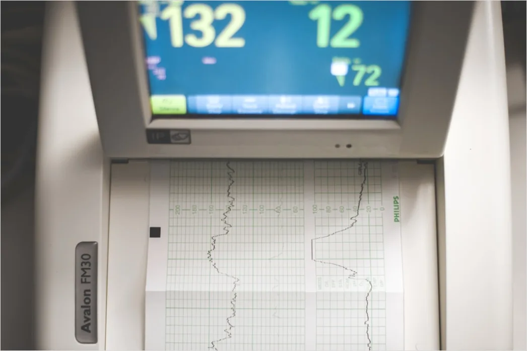 Detail Icu Monitor Alarms Waveform Number 12