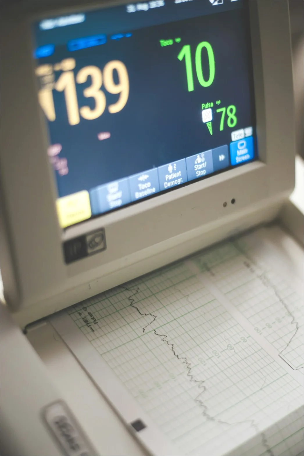 Detail Icu Monitor Alarms Waveform Number 13