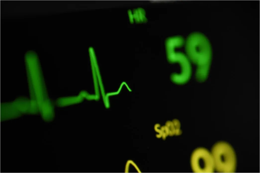 Detail Icu Monitor Alarms Waveform Number 15