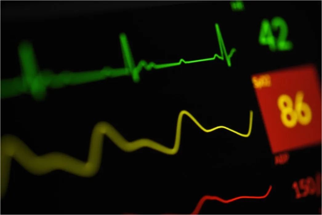 Detail Icu Monitor Alarms Waveform Number 5
