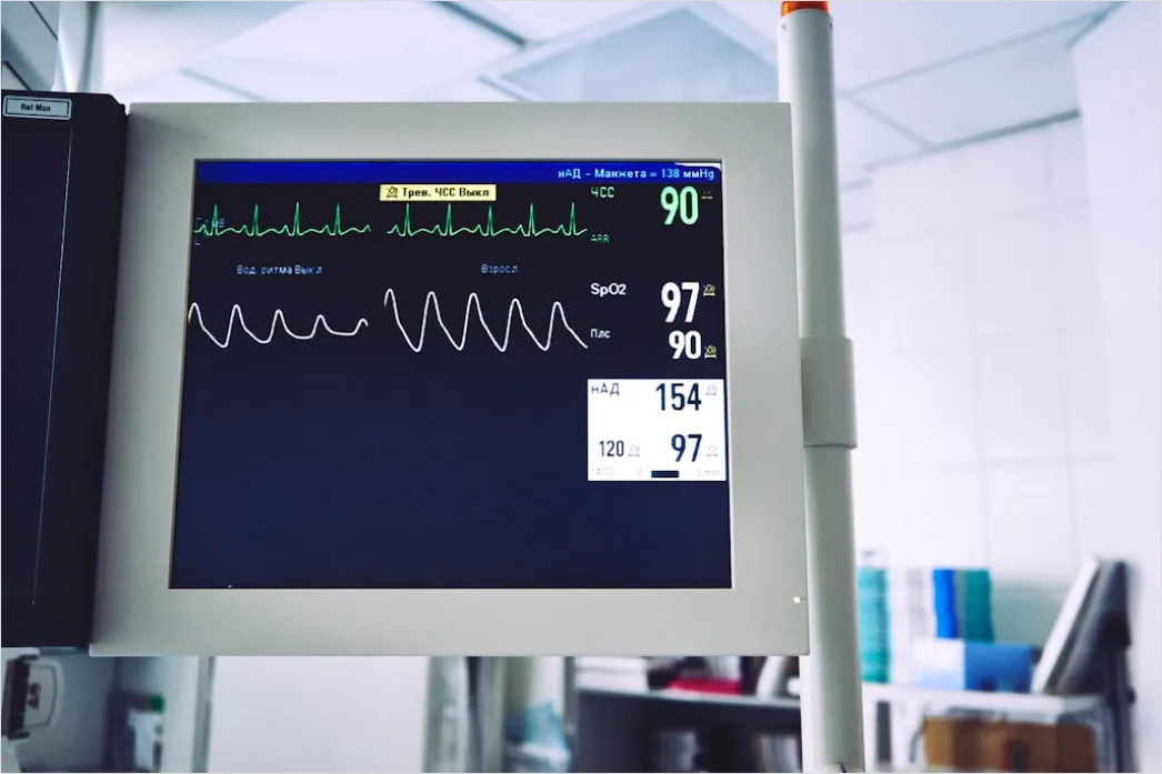 Detail Icu Monitor Alarms Waveform Number 9