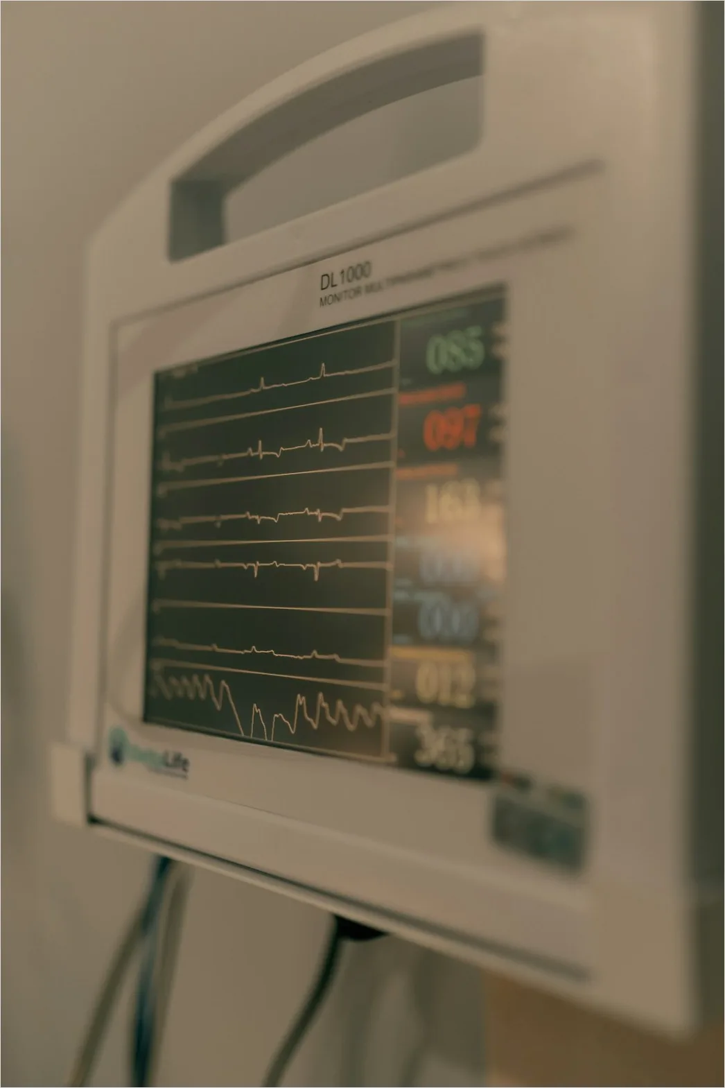 Detail Icu Monitor Alarms Waveform Number 10