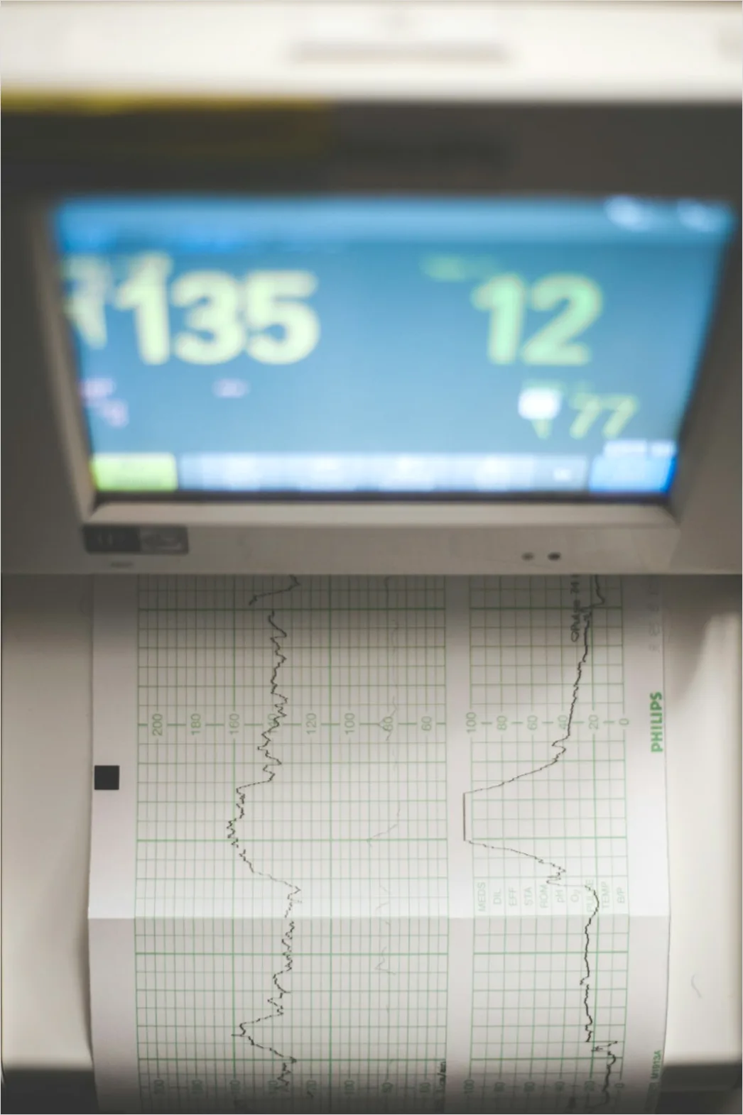 Detail Medical Research Data Charts Clipboard Number 13